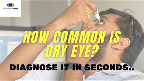 tear test for dry eyes|tear break up time test.